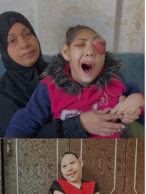 هناء العوضى المريضة بالسرطان