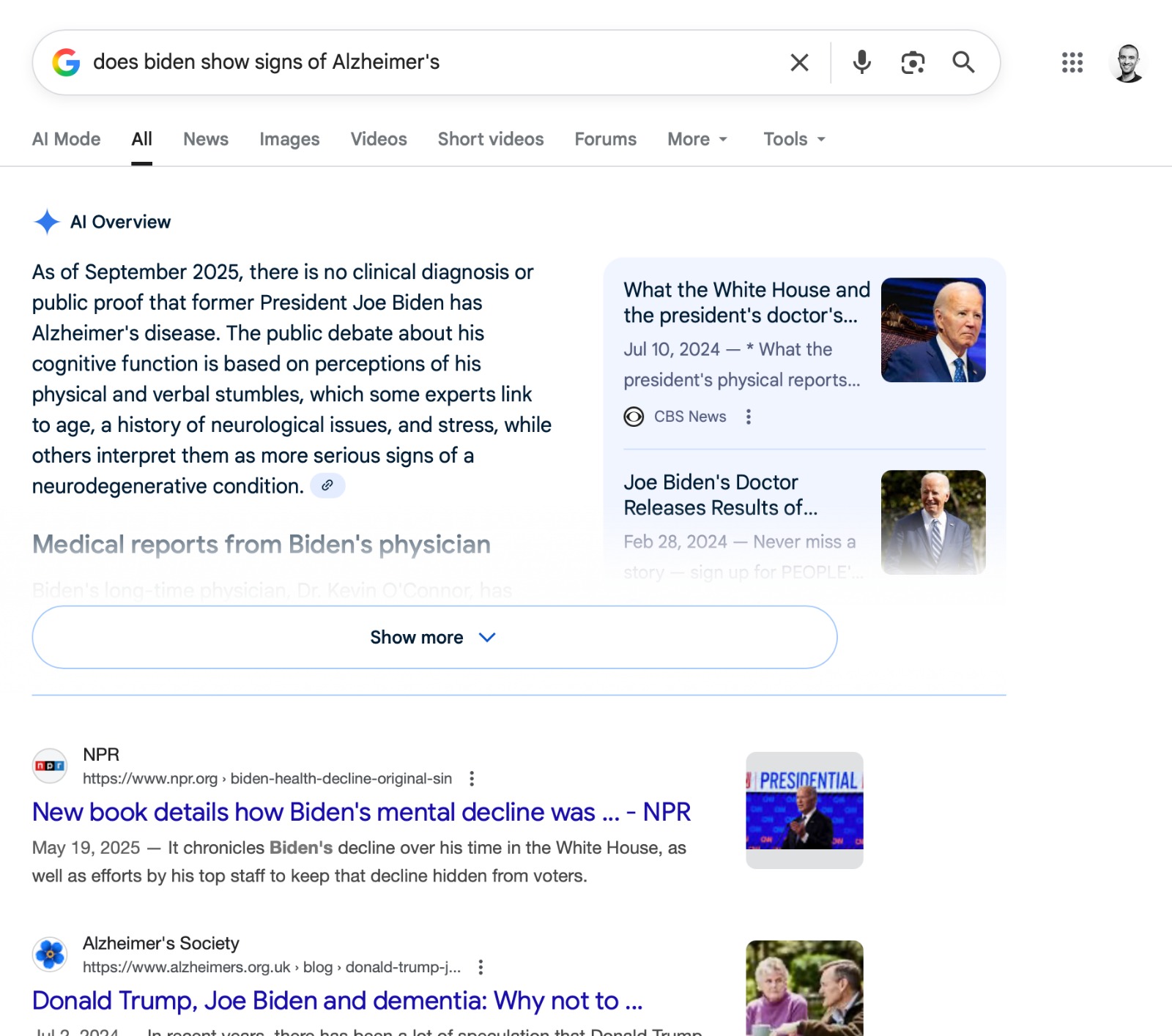 البحث عن بايدن ومرض الزهايمر