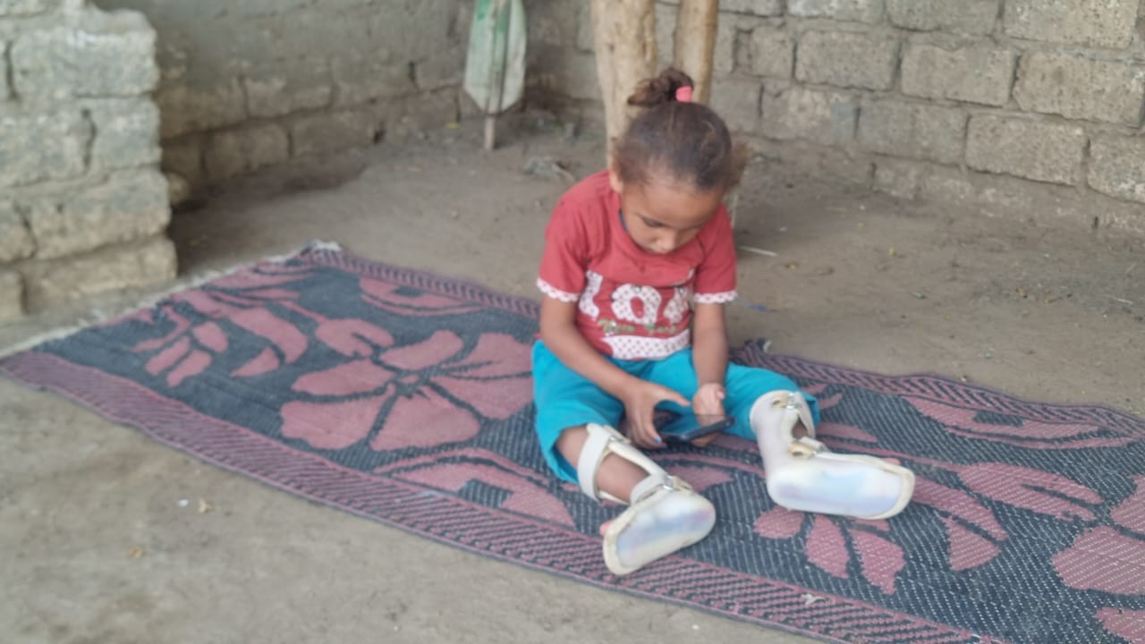 الطفلة ترتدى جعاز طبى الطفلة ترتدى جعاز طبى