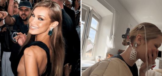 مراحل علاج بيلا حديد  (2)