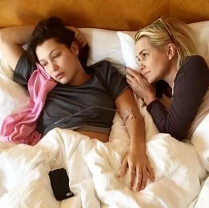 مراحل علاج بيلا حديد  (4)