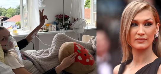 مراحل علاج بيلا حديد  (3)