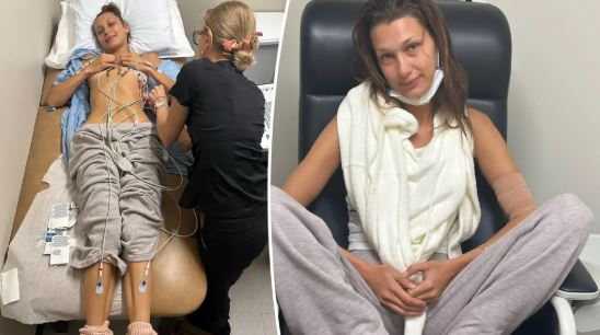 مراحل علاج بيلا حديد  (5)