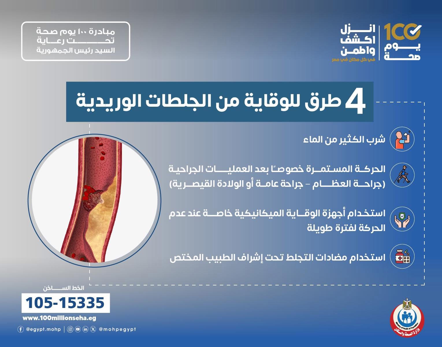 4 طرق  للوقاية من الجلطات الوريدية