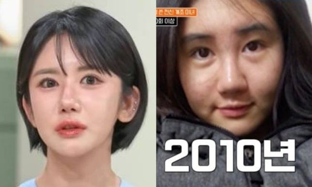 كورية قبل وبعد عمليات تجميل خلال 15 عام