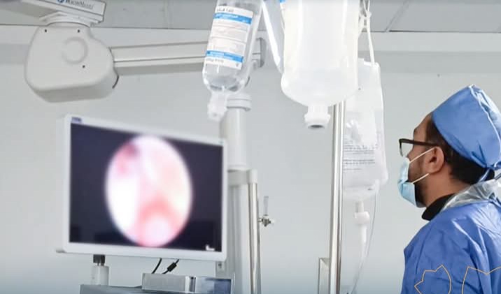 احدث المناظير احدث المناظير