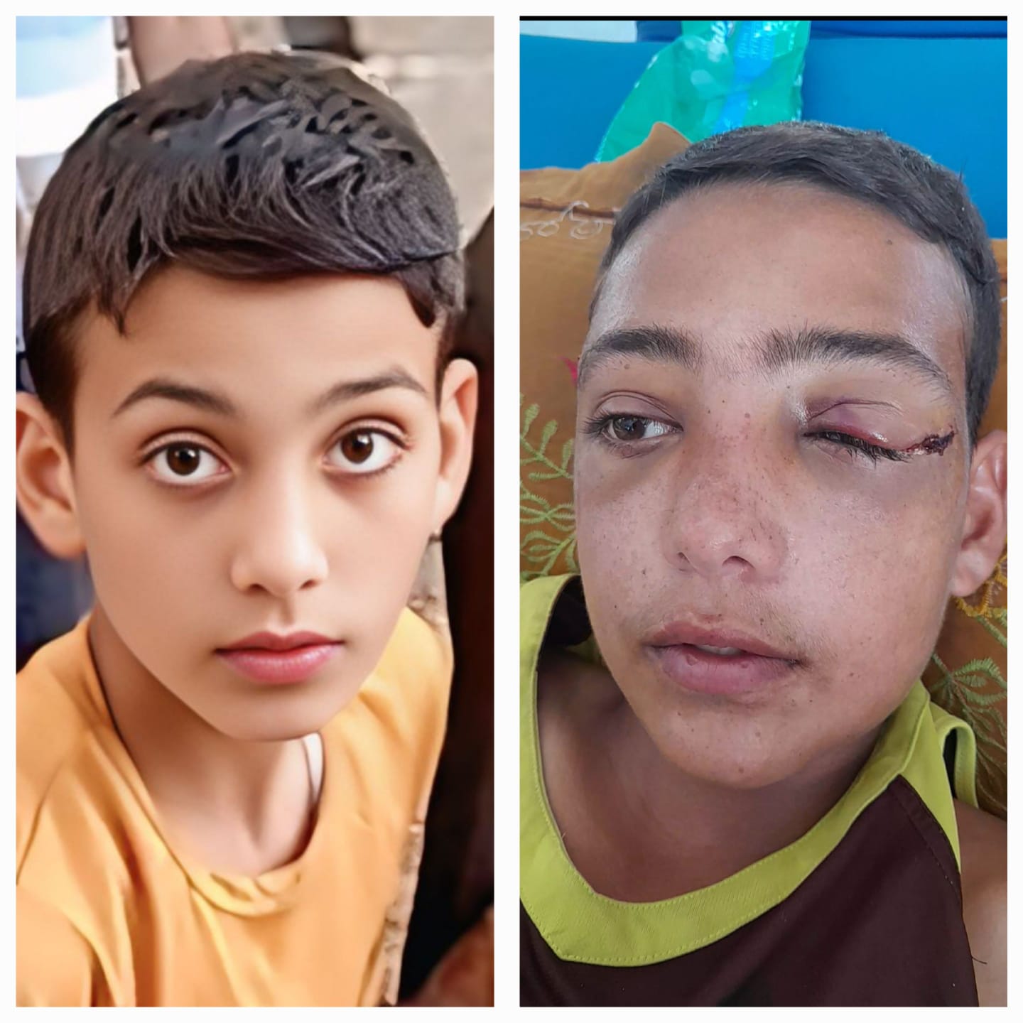 الطفل عبد الرحمن أبو جزر