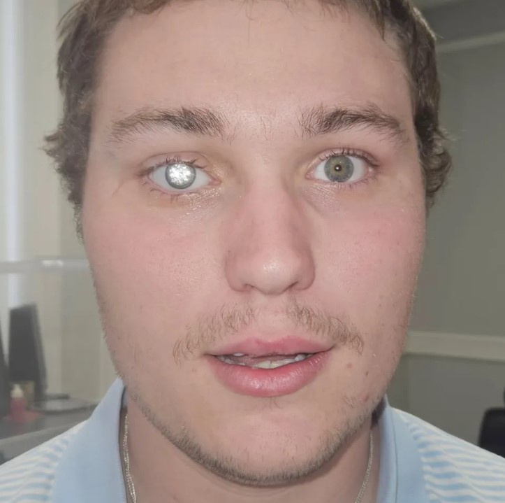 البريطانى يرتدى عين من الماس البريطانى يرتدى عين من الماس