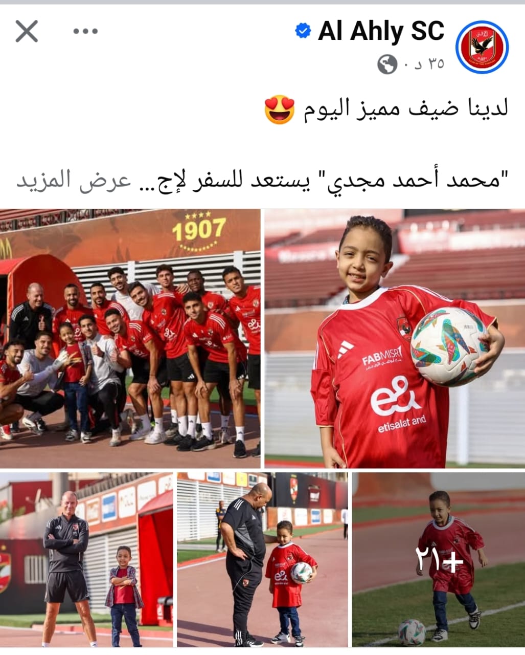 لاعبو الاهلي يتضامنون مع طفل يستعد لعملية زرع نخاع