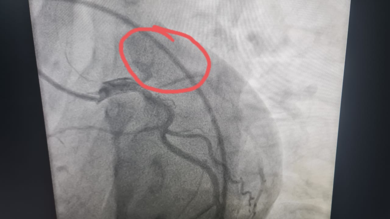 طبي بمستشفى طهطا العام ينقذ حياة شاب