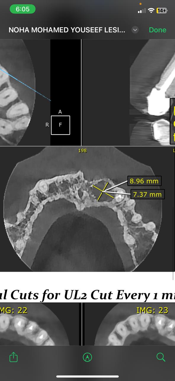 1000887037 1000887037