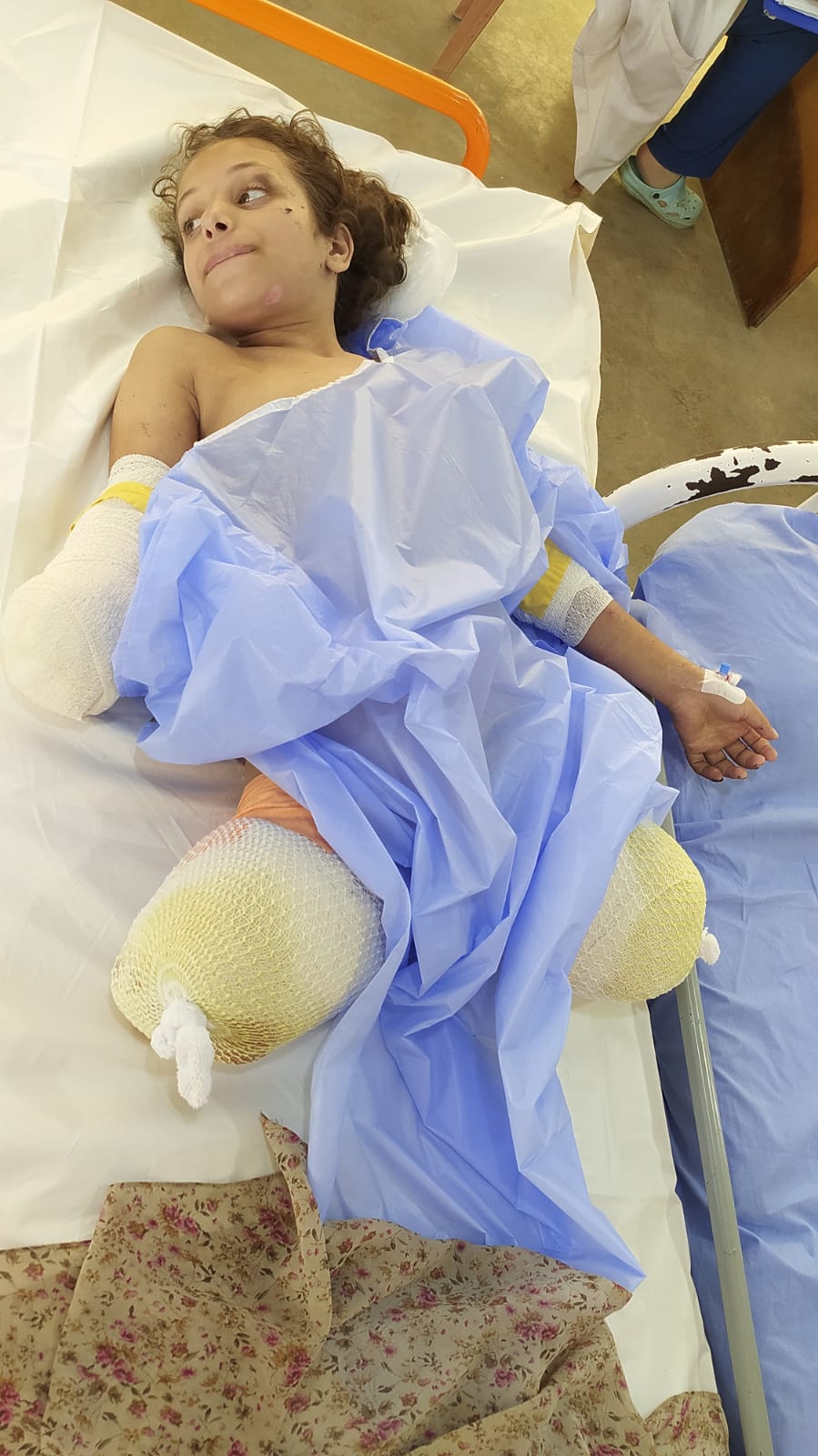 نور فرج مبتورة ألأطراف