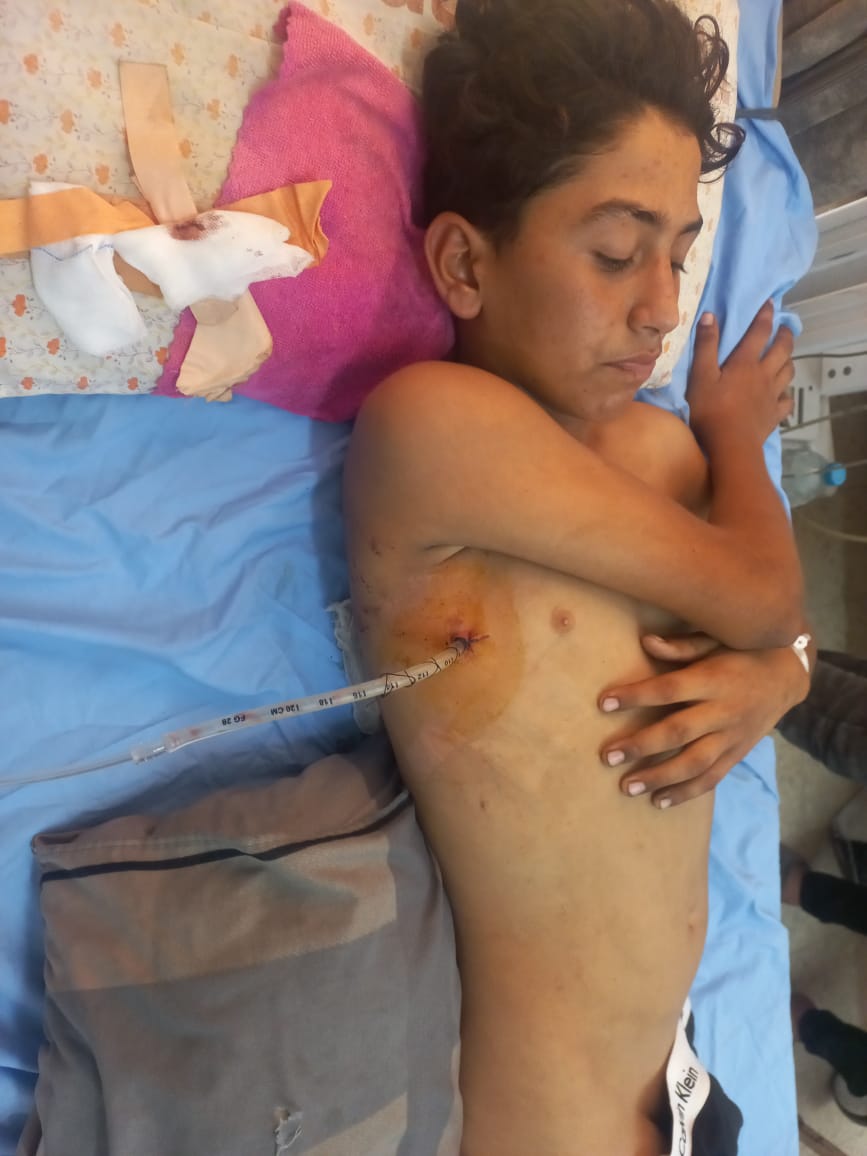 محمد أبو حلس بعد الإصابة محمد أبو حلس بعد الإصابة