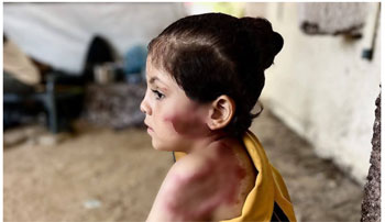 جودماضي بعدالحرب