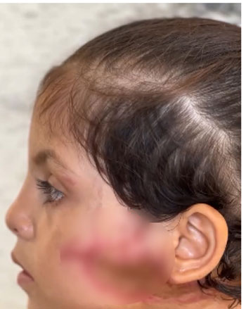 الطفلة جود ماضي