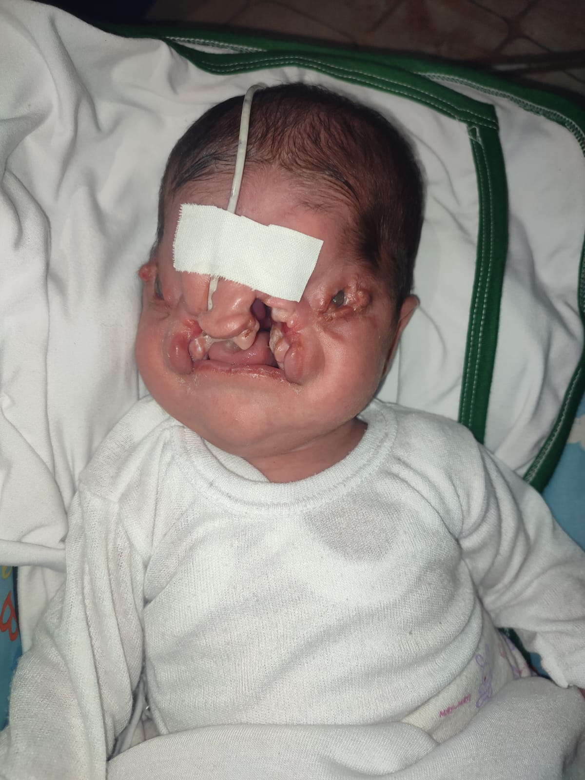 الطفلة حكمة نوفل في غزة الطفلة حكمة نوفل في غزة