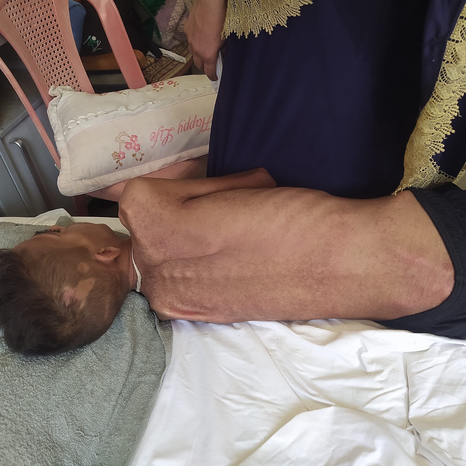 إصابات الطفل حلمى بربخ