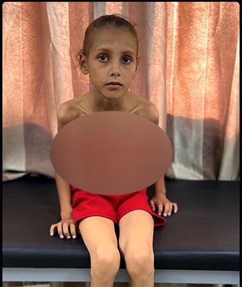 438569-الطفلة-بيان-صقر-بعد-الإصابة 438569-الطفلة-بيان-صقر-بعد-الإصابة