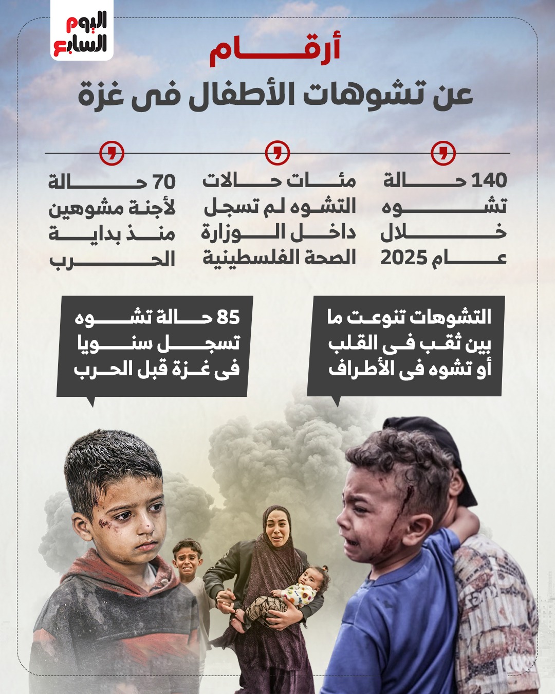 أرقام عن تشوهات الأطفال في غزة أرقام عن تشوهات الأطفال في غزة