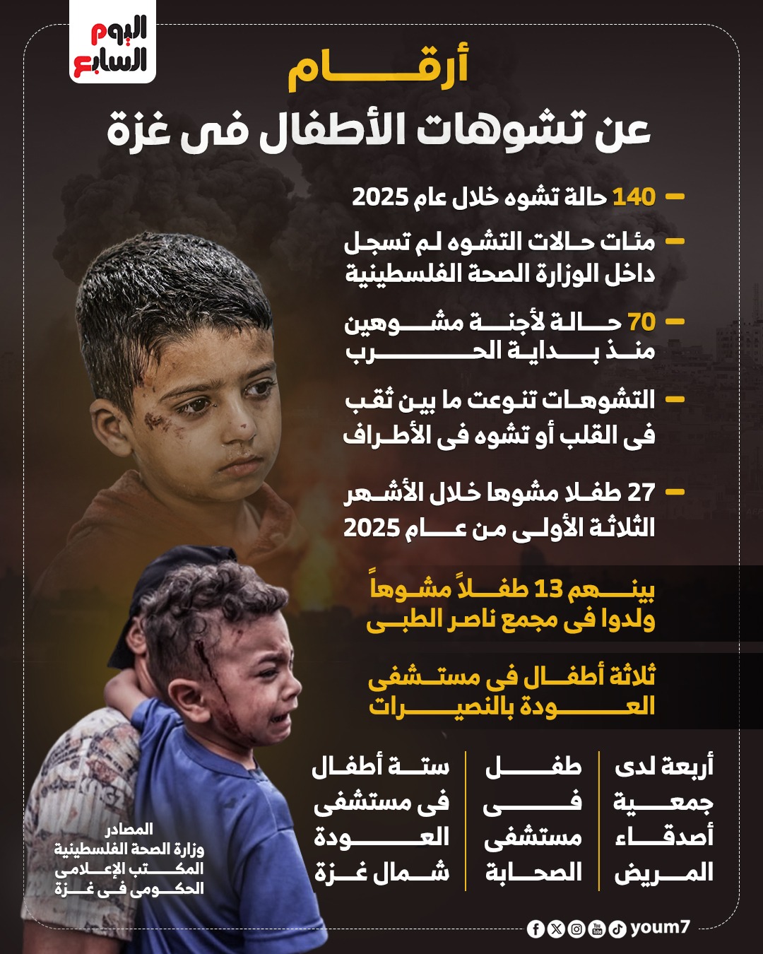 أرقام عن تشوه الأطفال في غزة أرقام عن تشوه الأطفال في غزة