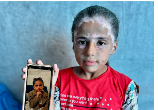 لانا الشريف قبل وبعد تشويه وجهها لانا الشريف قبل وبعد تشويه وجهها