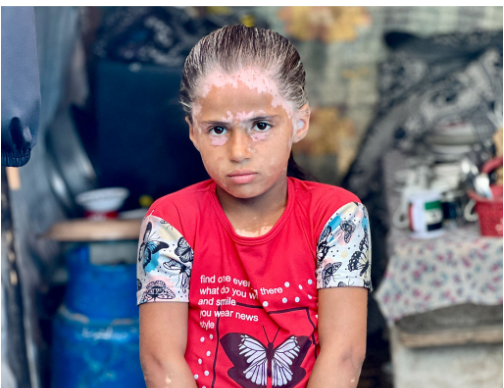 الطفلة لانا الشريف الطفلة لانا الشريف