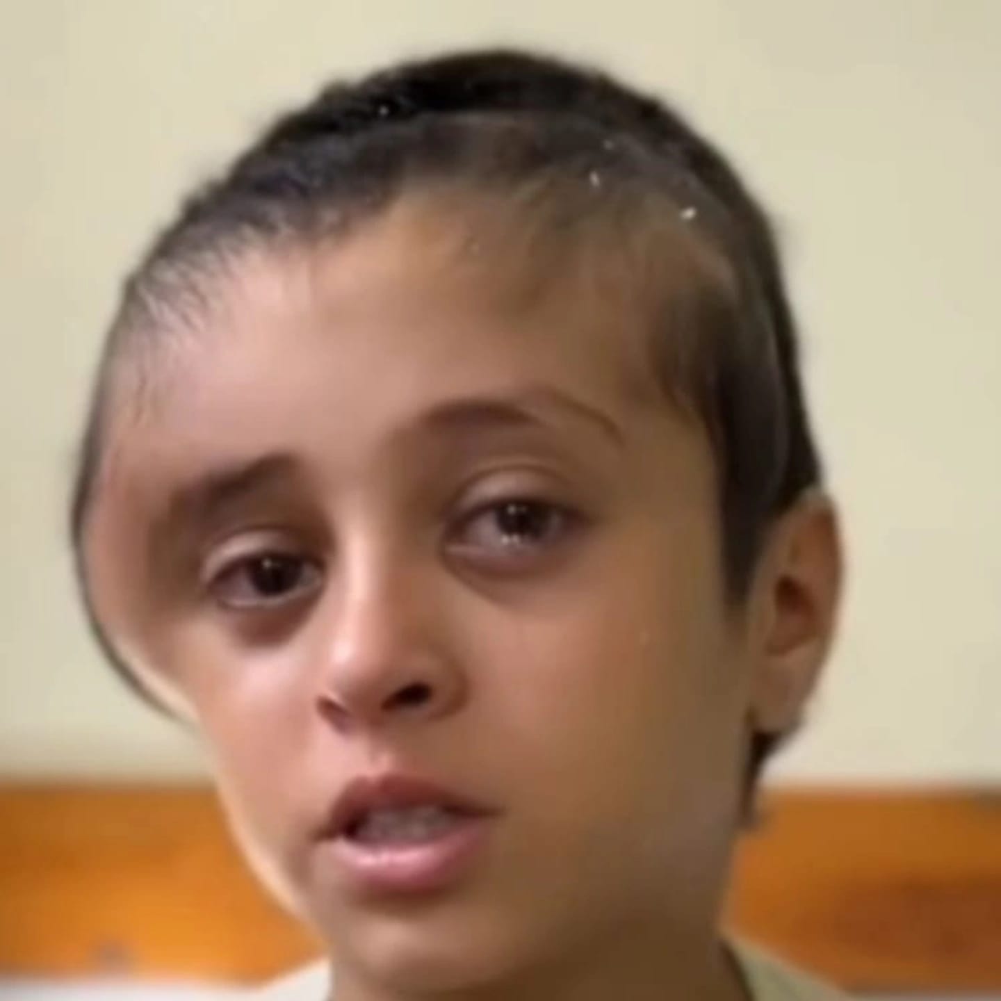 الطفلة المصابة مريم إبراهيم الطفلة المصابة مريم إبراهيم