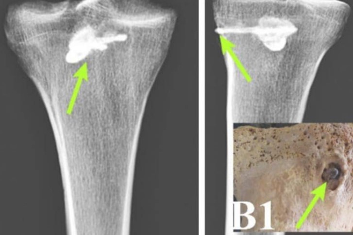 فحص رفات رجل عمره 2000 عام