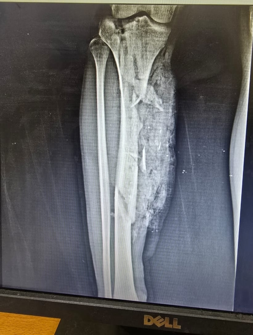 الأشعة الخاصة بالمريض