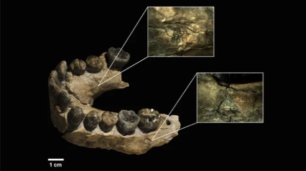 عظم فك للإنسان العاقل