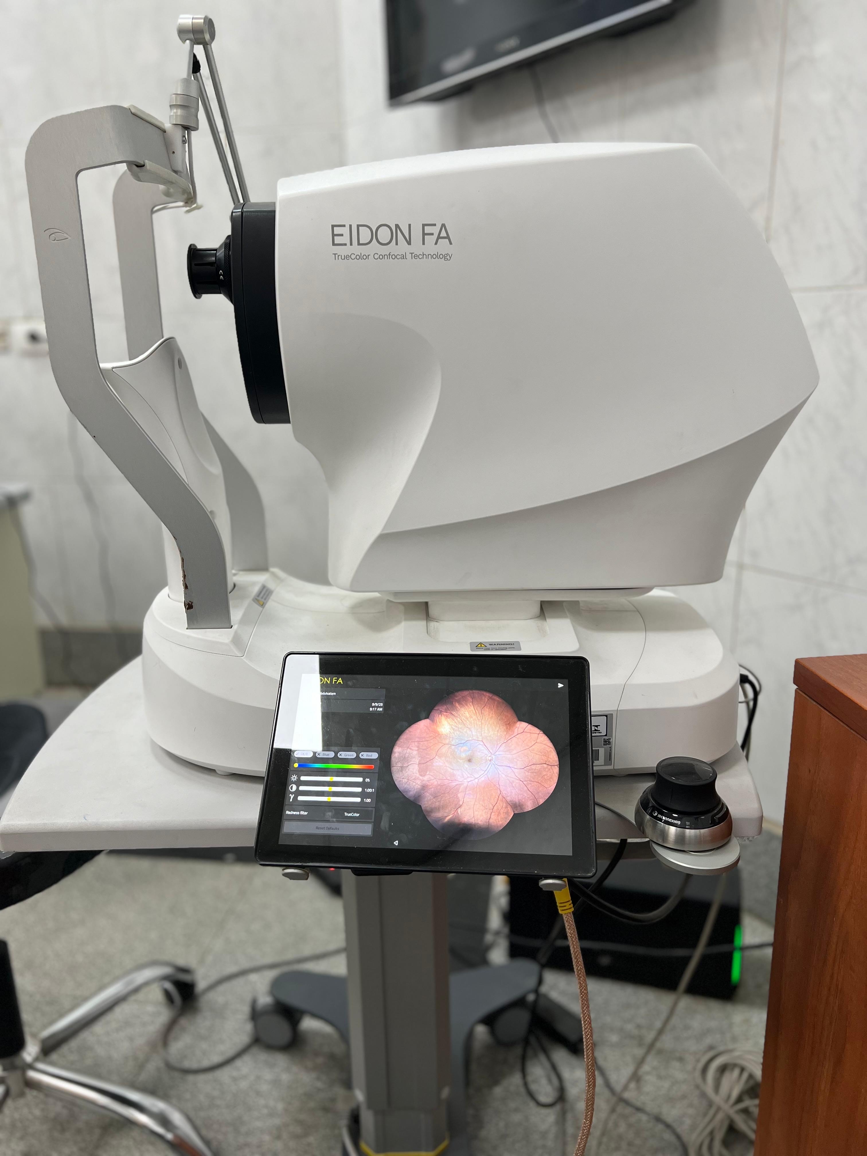 وحدة أورام العيون بقصر العينى 