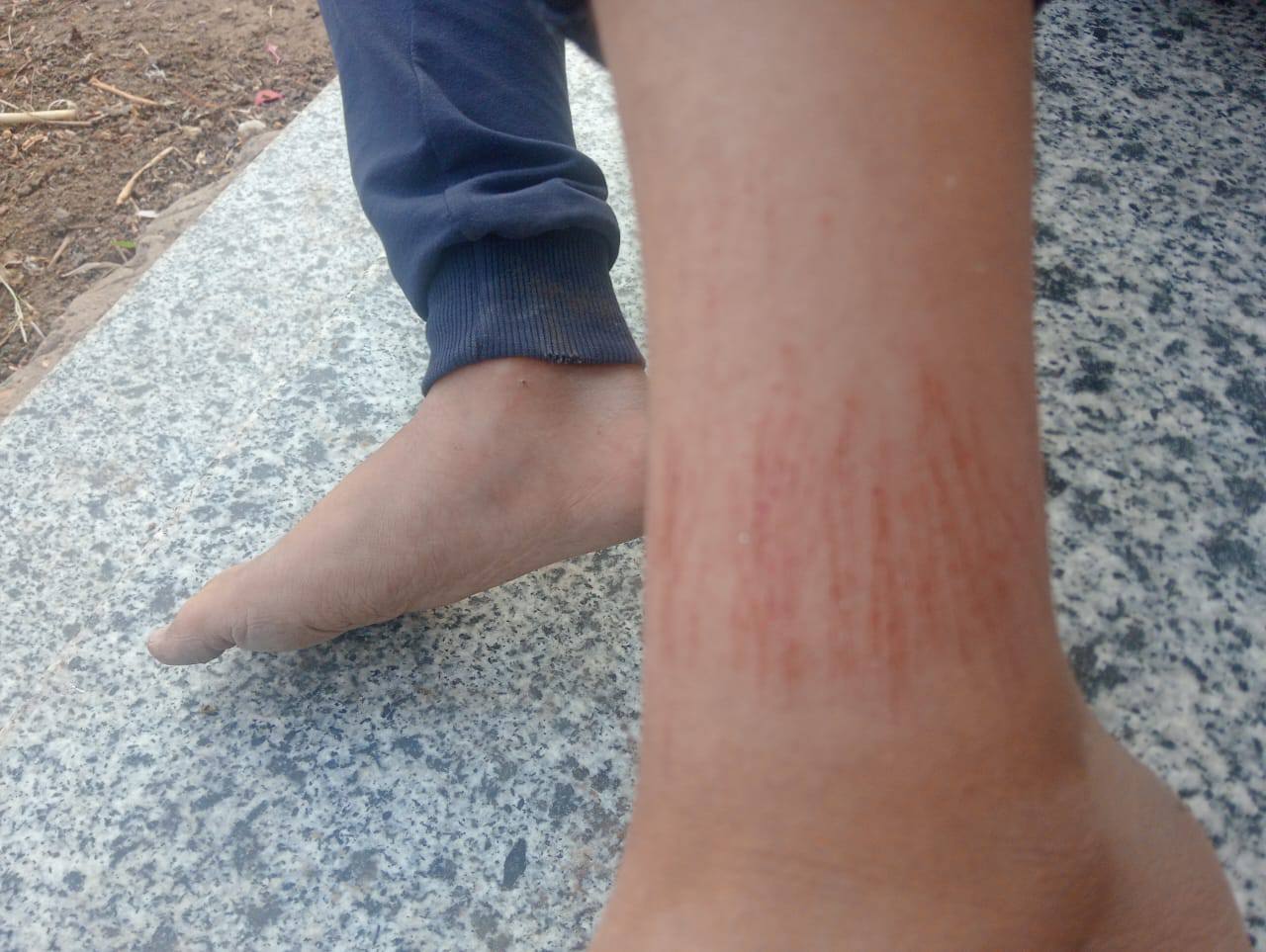 التعدي على التلميذ