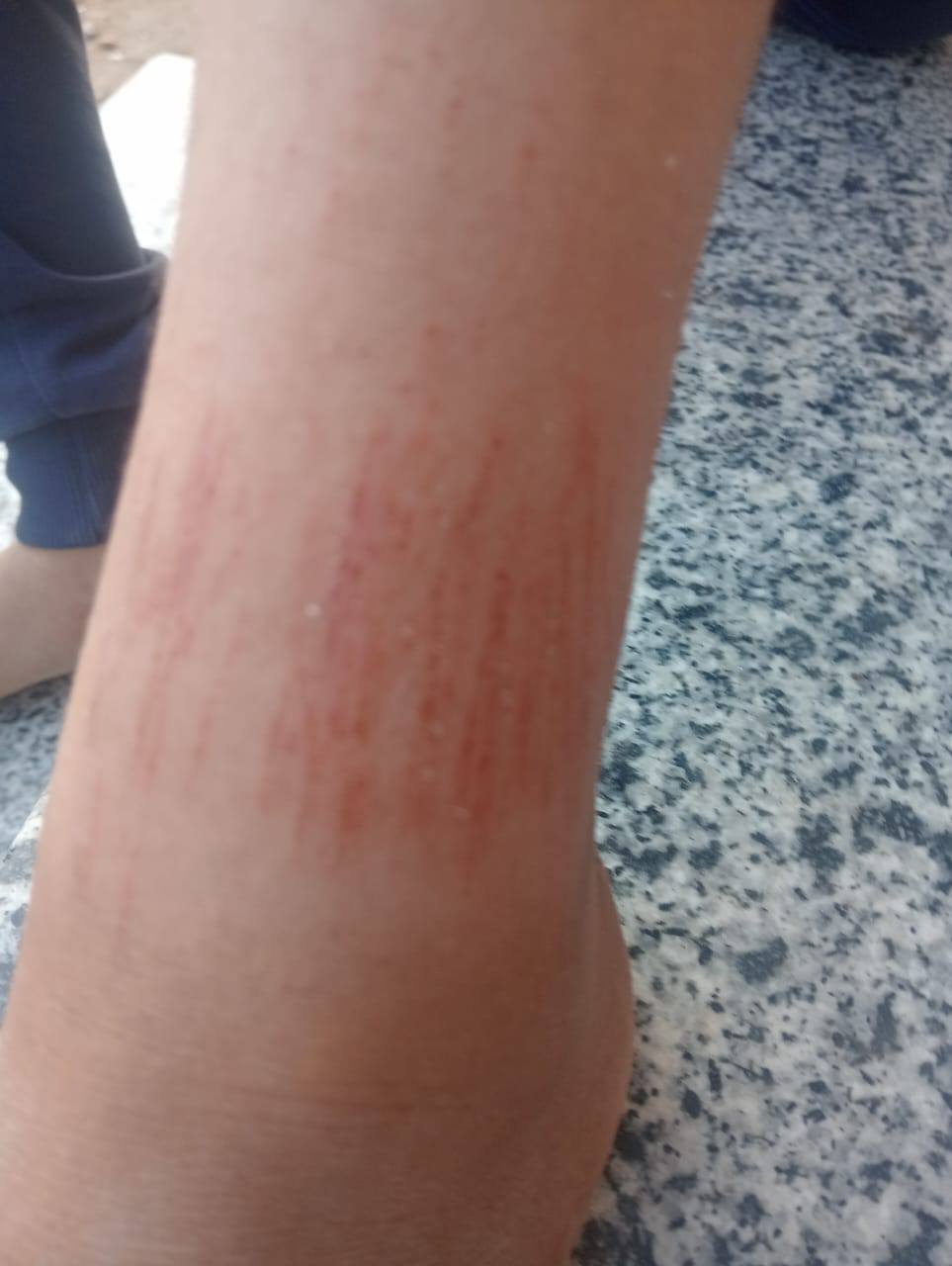 أثار التعدي على التلميذ