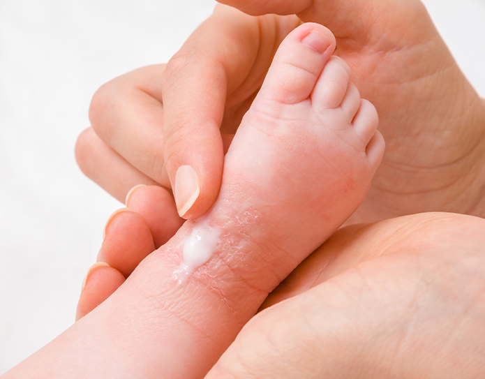 بشرة الاطفال 