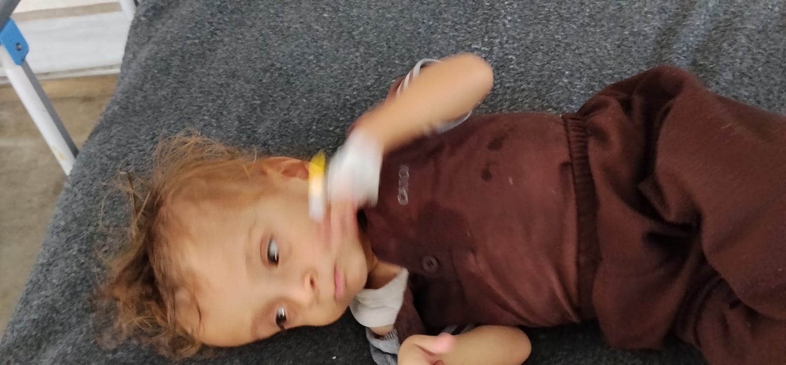 الطفل المصاب محمد أبو طعيمة