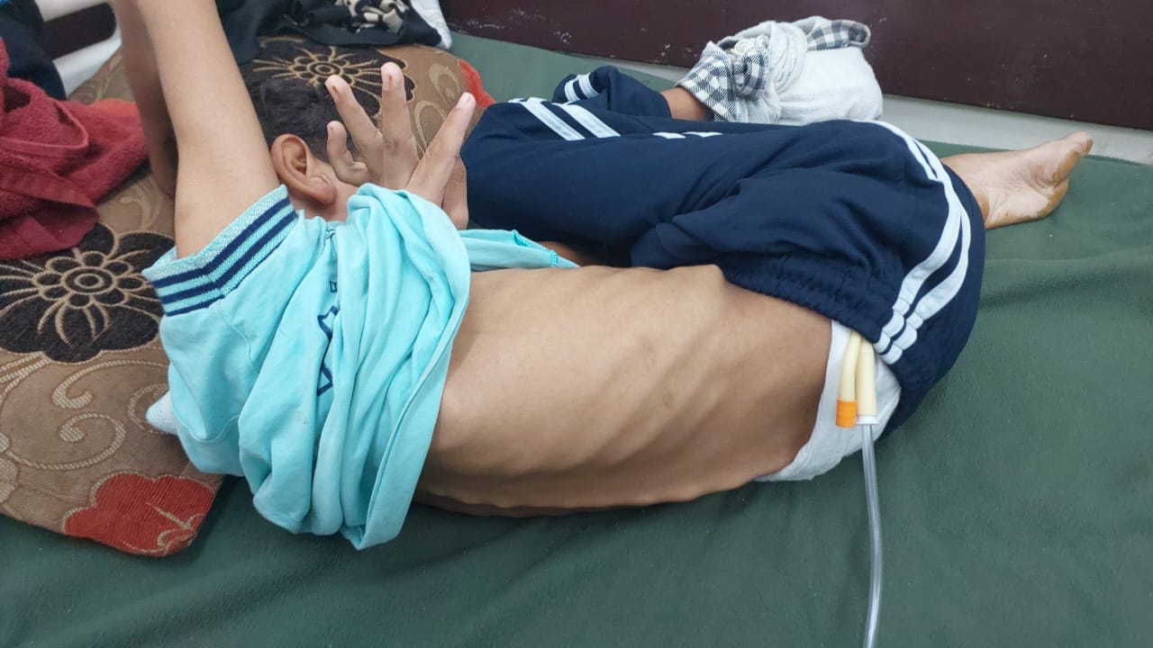 إصابة يوسف أبو عمرة