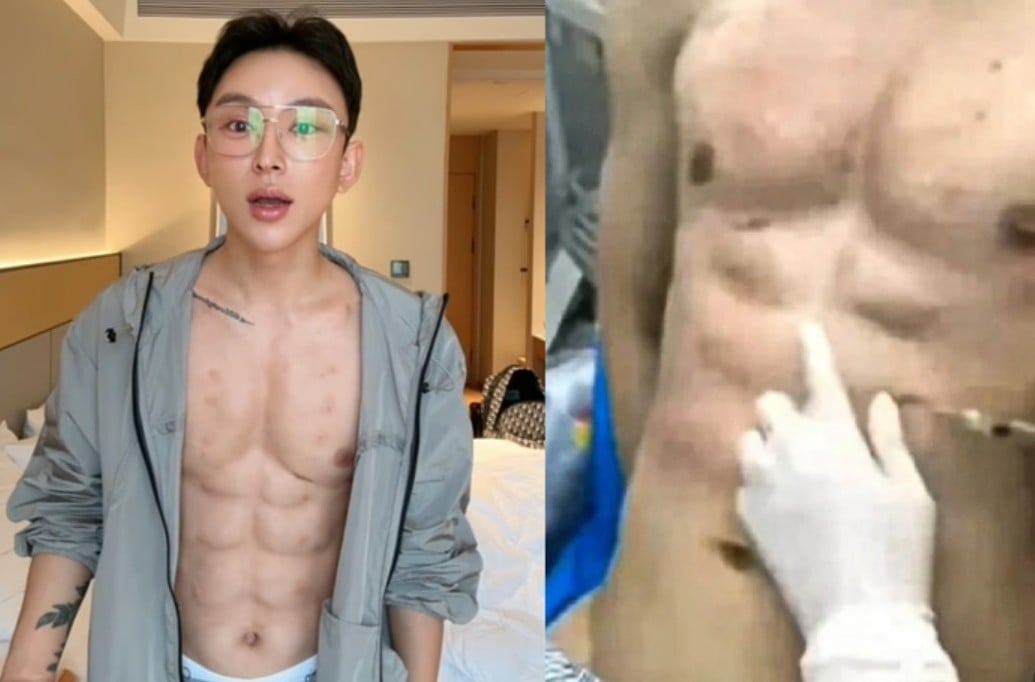 رجل ينفق الأموال للحصول على عضلات وهمية رجل ينفق الأموال للحصول على عضلات وهمية