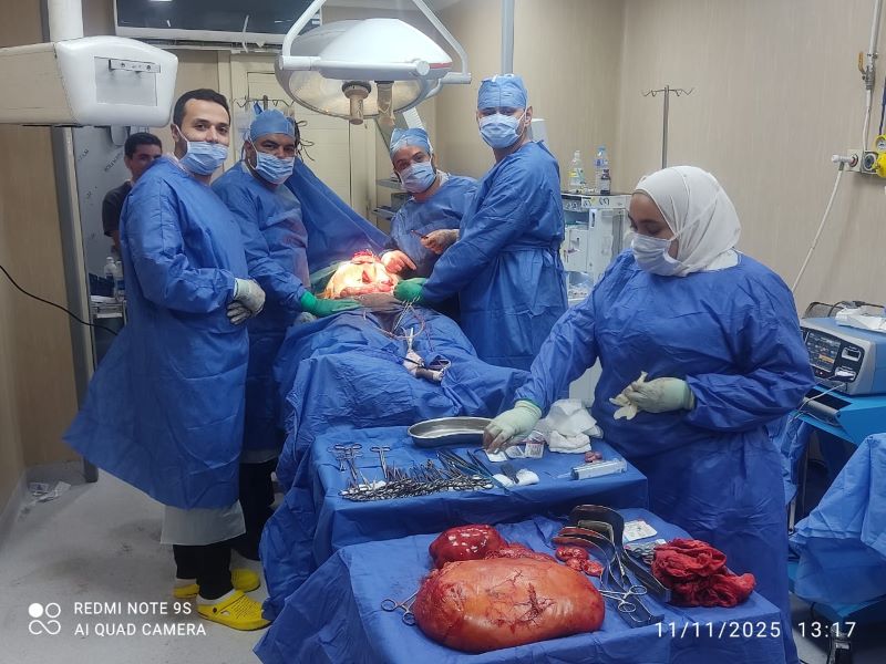 نجاح فريق طبي باستئصال ورم ضخم بالبطن 