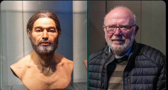 إعادة بناء وجه