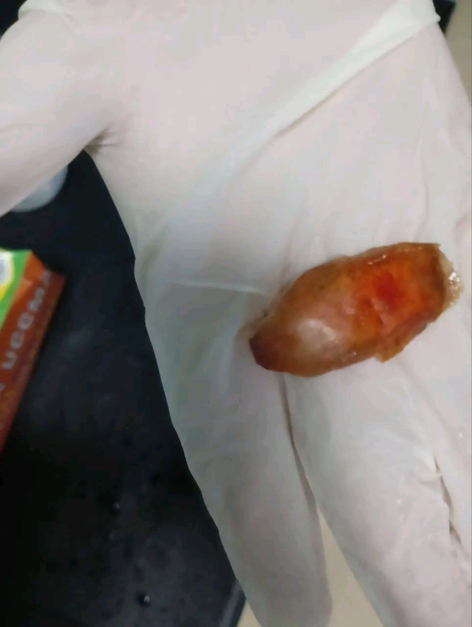 التمرة التي ابتلاعها الطفل