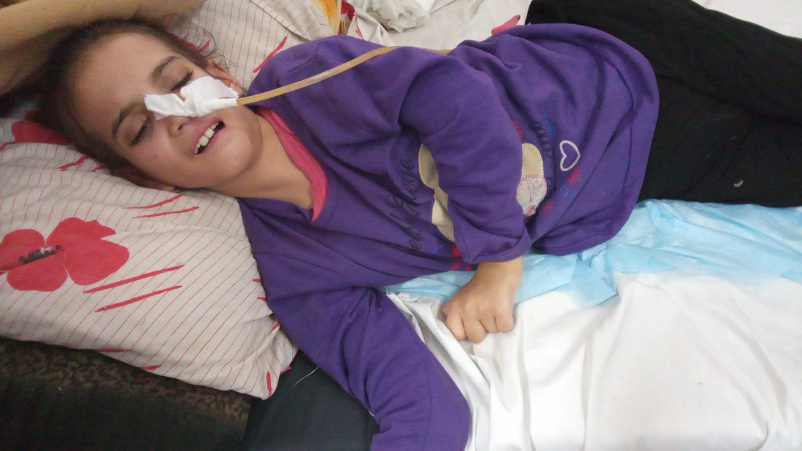 الطفلة المريضة سمر البشيتي الطفلة المريضة سمر البشيتي