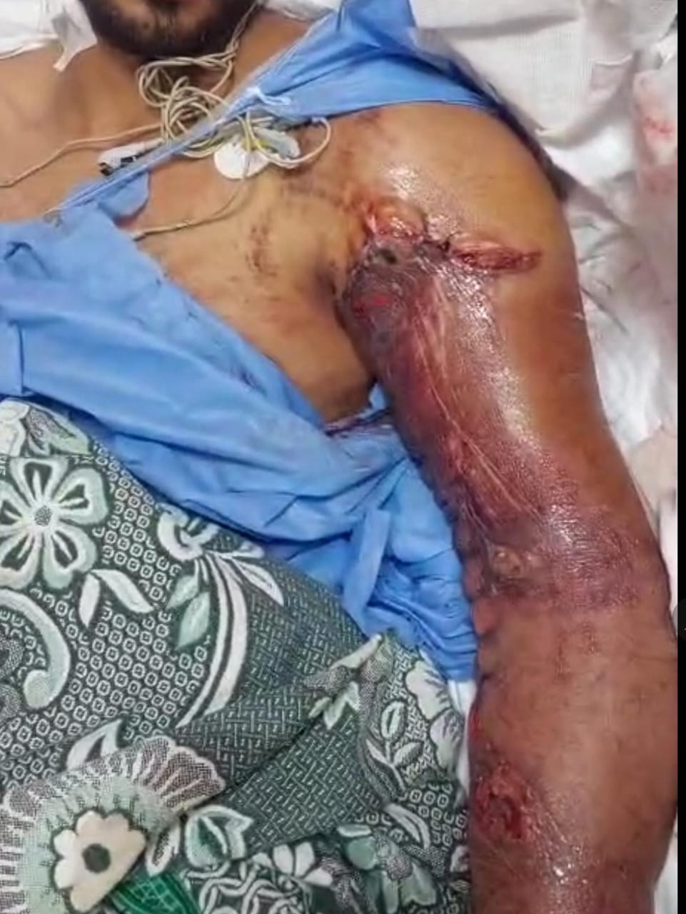 إنجاز طبي كبير بوحدة الجراحات الميكروسكوبية بسوهاج الجامعي إنجاز طبي كبير بوحدة الجراحات الميكروسكوبية بسوهاج الجامعي