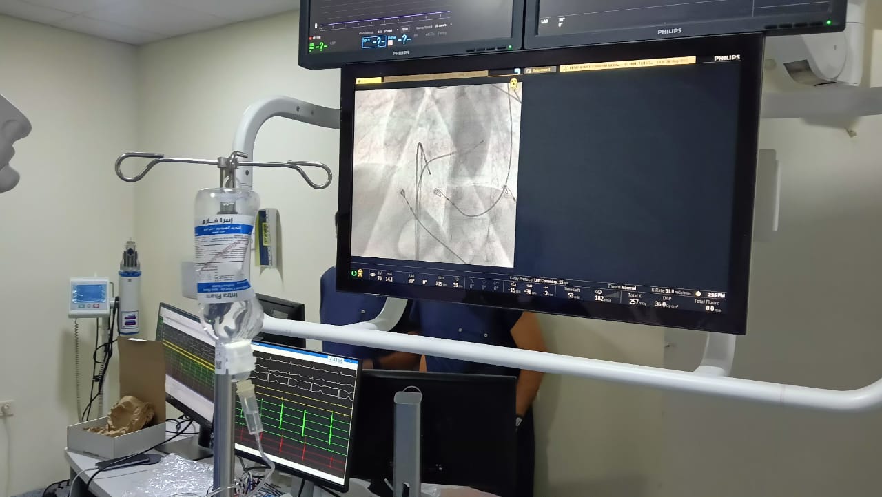 تشغيل جهاز كهربية القلب