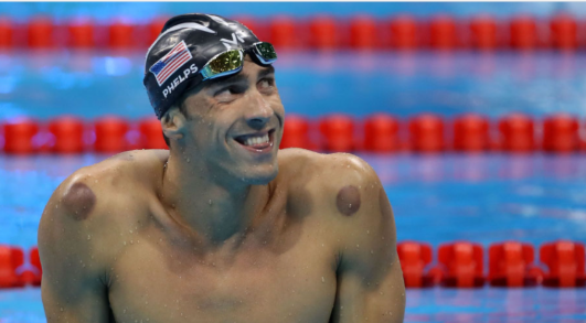 مايكل فيليبس