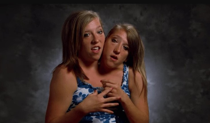 أبيجيل وبريتاني هينسيل 