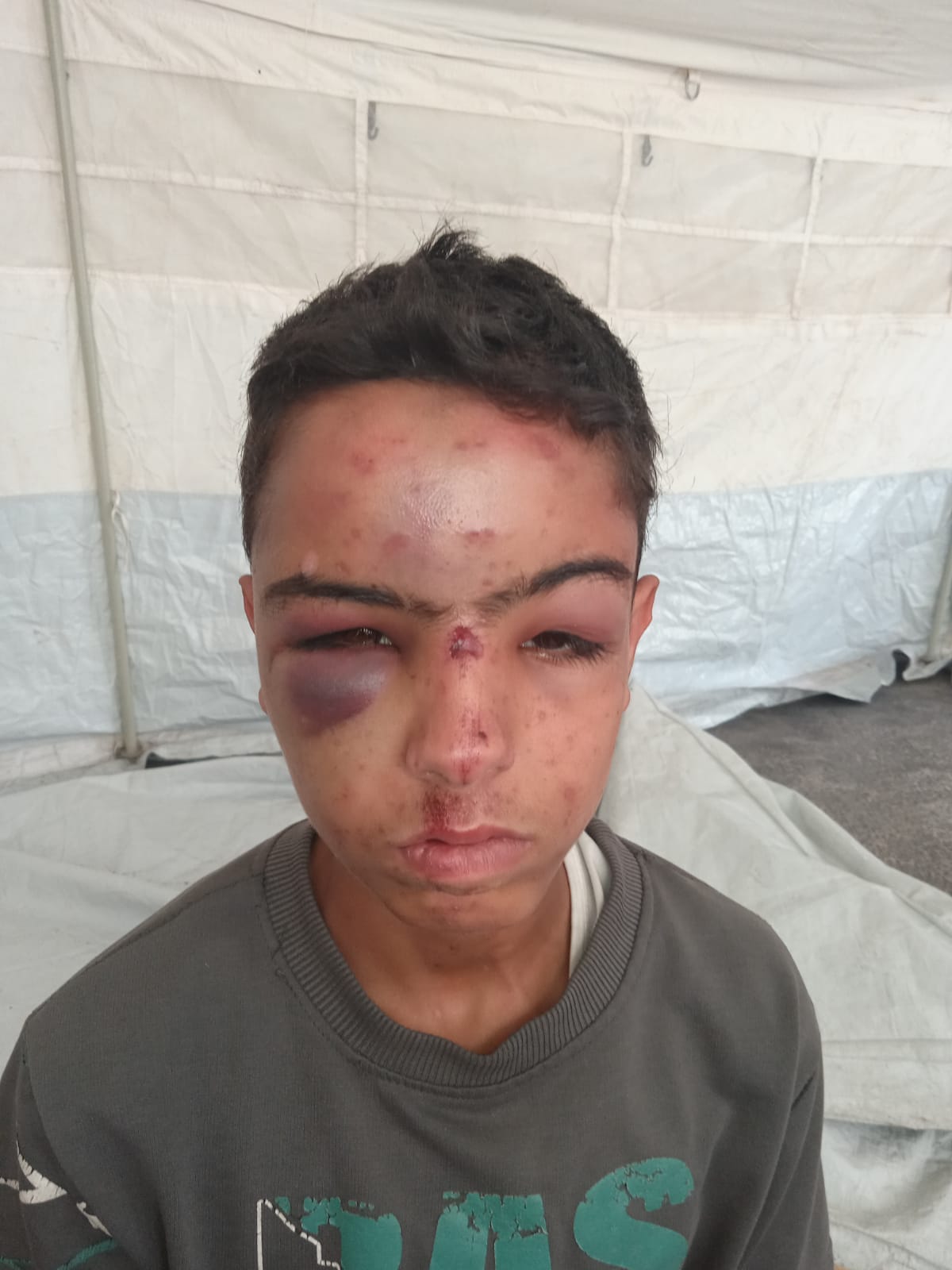 الطفل الفلسطيني المصاب عبدالله عصفور