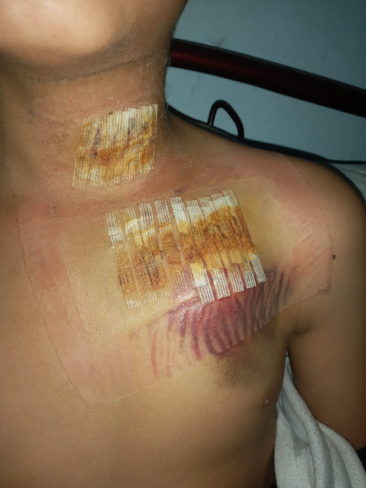 إصابة عبد الله عصفور