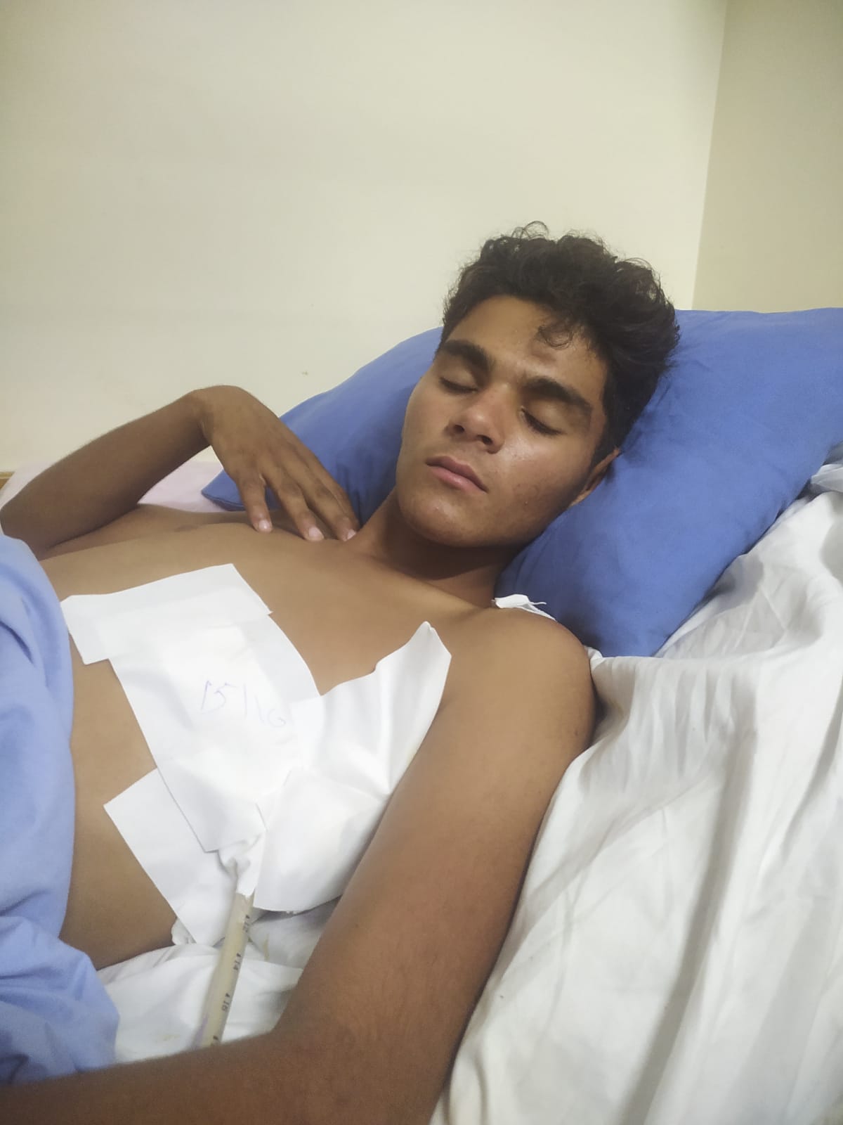 الطفل المصاب مصطفى أبو طالب