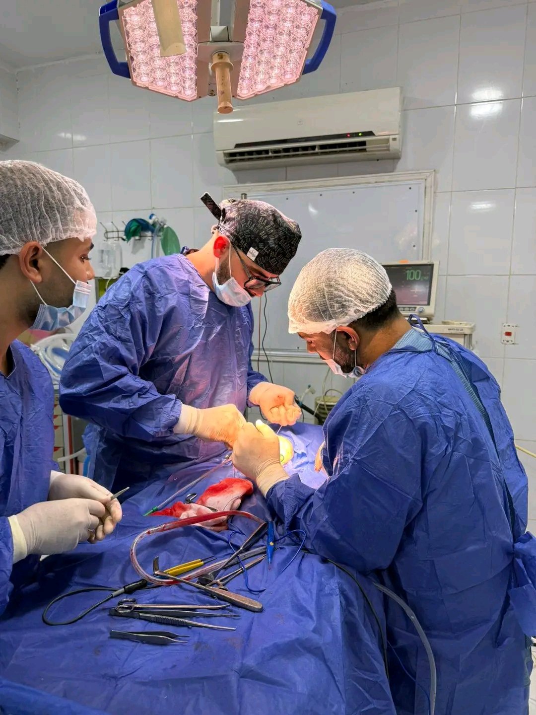 الرضيع اثناء العملية