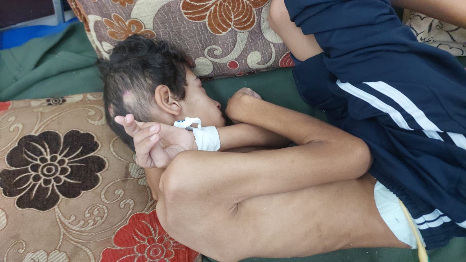 الطفل يوسف أبو عمرة الطفل يوسف أبو عمرة